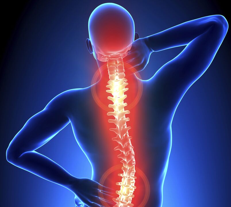 Osteocondrose da columna vertebral